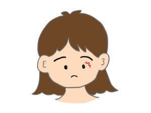 眼瞼痙攣